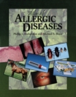 Image for Atlas of Allergic Diseases