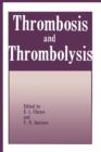 Image for Thrombosis and Thrombolysis