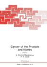 Image for Cancer of the Prostate and Kidney