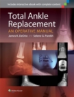 Image for Total ankle replacement: an operative manual