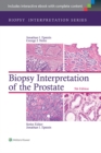 Image for Biopsy interpretation of the prostate
