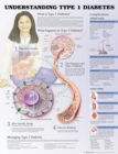 Image for Understanding Type 1 Diabetes Anatomical Chart