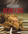 Image for What You Need to Know about Head Lice