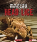 Image for What you need to know about head lice