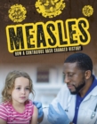 Image for Measles  : how a contagious rash changed history