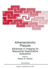 Image for Atherosclerotic Plaques: Advances in Imaging for Sequential Quantitative Evaluation