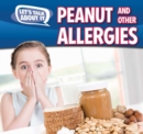 Image for Peanut and Other Food Allergies