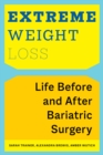 Image for Extreme weight loss: life before and after bariatric surgery