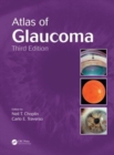 Image for Atlas of Glaucoma