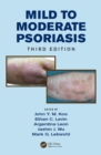 Image for Mild to moderate psoriasis