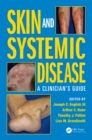 Image for Skin and systemic disease: a clinician&#39;s guide / $c edited by Joseph C. English III, MD, Professor of Dermatology, Arthur C. Huen, MD, PhD, Instructor in Dermatology, Timothy J. Patton, DO, Assistant Professor of Dermatology, Lisa M. Grandinetti, MD, Assistant Professor of D