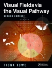 Image for Visual Fields via the Visual Pathway