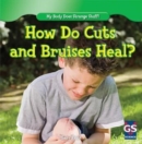 Image for How Do Cuts and Bruises Heal?