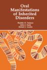 Image for Oral manifestations of inherited disorders
