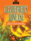 Image for Alzheimer&#39;s Disease