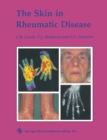 Image for Skin in Rheumatic Disease