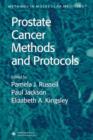 Image for Prostate Cancer Methods and Protocols
