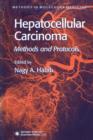 Image for Hepatocellular Carcinoma