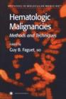 Image for Hematologic Malignancies