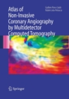 Image for Atlas of Non-Invasive Coronary Angiography by Multidetector Computed Tomography