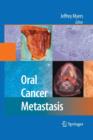 Image for Oral Cancer Metastasis