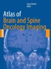 Image for Atlas of Brain and Spine Oncology Imaging