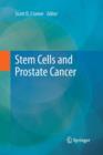 Image for Stem Cells and Prostate Cancer