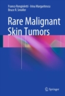 Image for Rare Malignant Skin Tumors