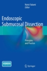 Image for Endoscopic Submucosal Dissection