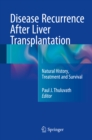 Image for Disease recurrence after liver transplantation: natural history, treatment and survival