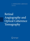 Image for Retinal Angiography and Optical Coherence Tomography