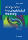 Image for Intraoperative Neurophysiological Monitoring