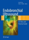 Image for Endobronchial Ultrasound