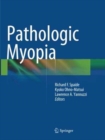 Image for Pathologic Myopia