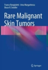 Image for Rare Malignant Skin Tumors