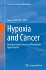 Image for Hypoxia and cancer  : biological implications and therapeutic opportunities
