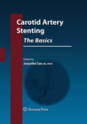 Image for Carotid Artery Stenting: The Basics
