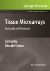 Image for Tissue Microarrays : Methods and Protocols