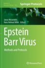 Image for Epstein Barr Virus