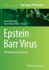 Image for Epstein Barr Virus