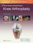 Image for Master Techniques in Orthopedic Surgery: Knee Arthroplasty