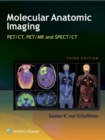 Image for Molecular anatomic imaging: PET-CT, PET-MR, and SPECT-CT