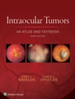 Image for Intraocular tumors: an atlas and textbook