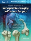 Image for Illustrated Tips and Tricks for Intraoperative Imaging in Fracture Surgery