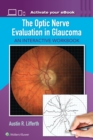 Image for The Optic Nerve Evaluation in Glaucoma : An Interactive Workbook
