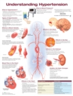 Image for Understanding Hypertension Anatomical Chart