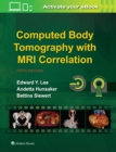 Image for Computed Body Tomography with MRI Correlation