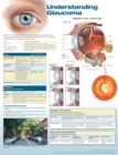Image for Understanding Glaucoma Anatomical Chart