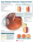 Image for Age-Related Macular Degeneration Anatomical Chart