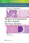 Image for Biopsy Interpretation of the Central Nervous System